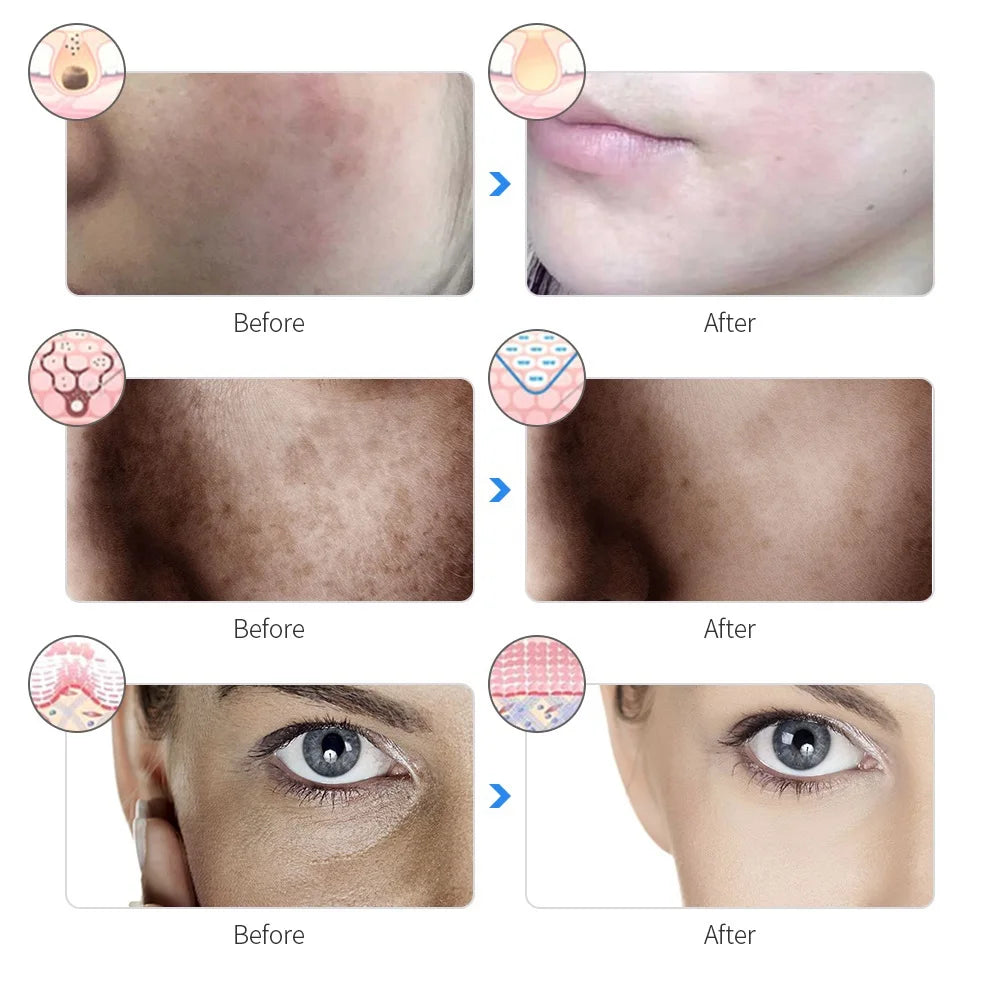 Mascarilla LED Facial de Fototerapia – 7 Colores Rechargeable Facial LED Mask 7 Colors LED Photon Beauty Mask Skin Rejuvenation Home Face Lifting Whitening Skin Care Beauty Mask
